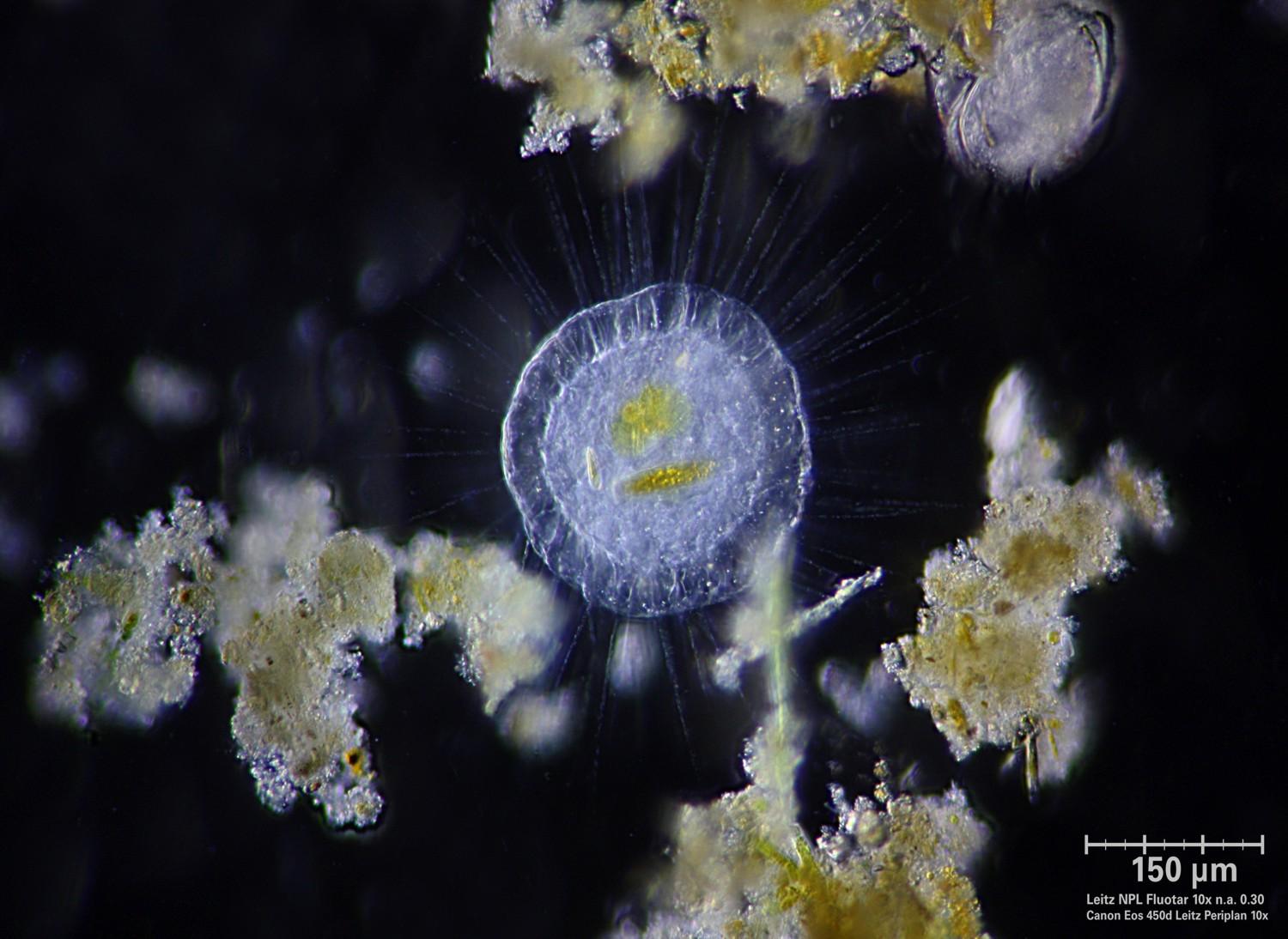 Actinosphaerium
